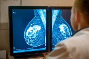 Breast lump types and diagnosis | Women’s Health Guide