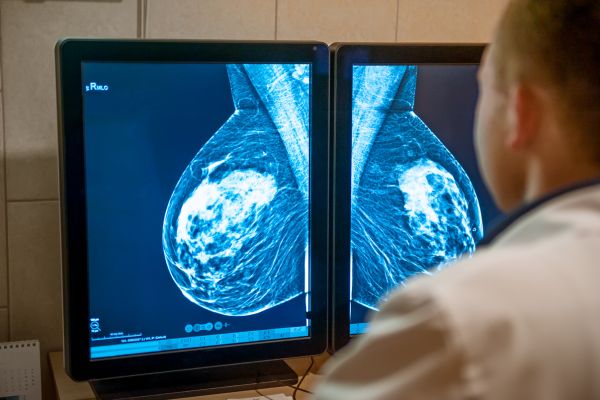 Breast lump types and diagnosis